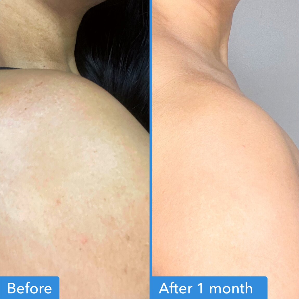 discoloration-correcting-body-treatment-x4 zb_p.jpg