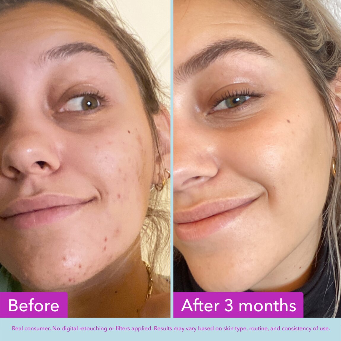 niacinamide-brightening-toner-n7 zb_p.jpg