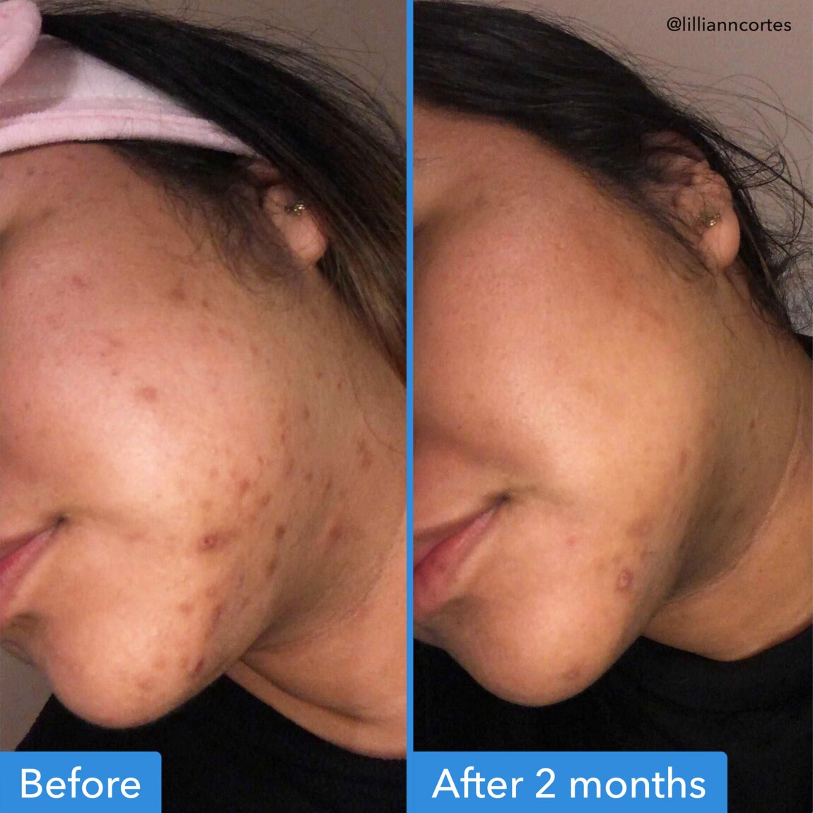 discoloration-correcting-serum-a4 zb_p.jpg